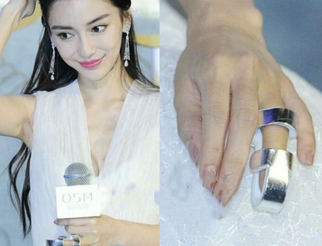 女明星骨折之旅，探寻内心平静的冒险之路